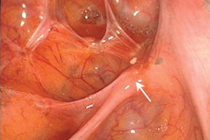 figure 12 endo.jpg