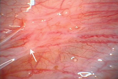 figure 3 endo.jpg