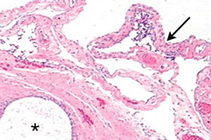 figure 9 endo.jpg