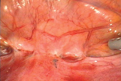 figure 6 endo.jpg