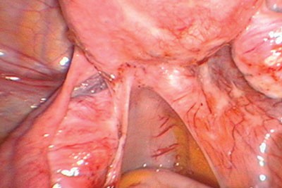 figure 13 endo.jpg