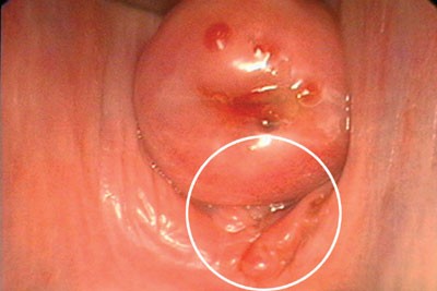 Figure 2 endo.jpg