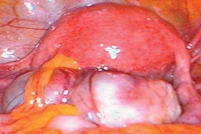 figure 7 endo.jpg