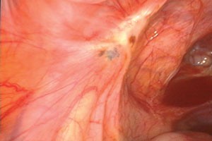 figure 10 endo.jpg