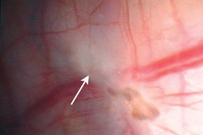 figure 4 endo.jpg